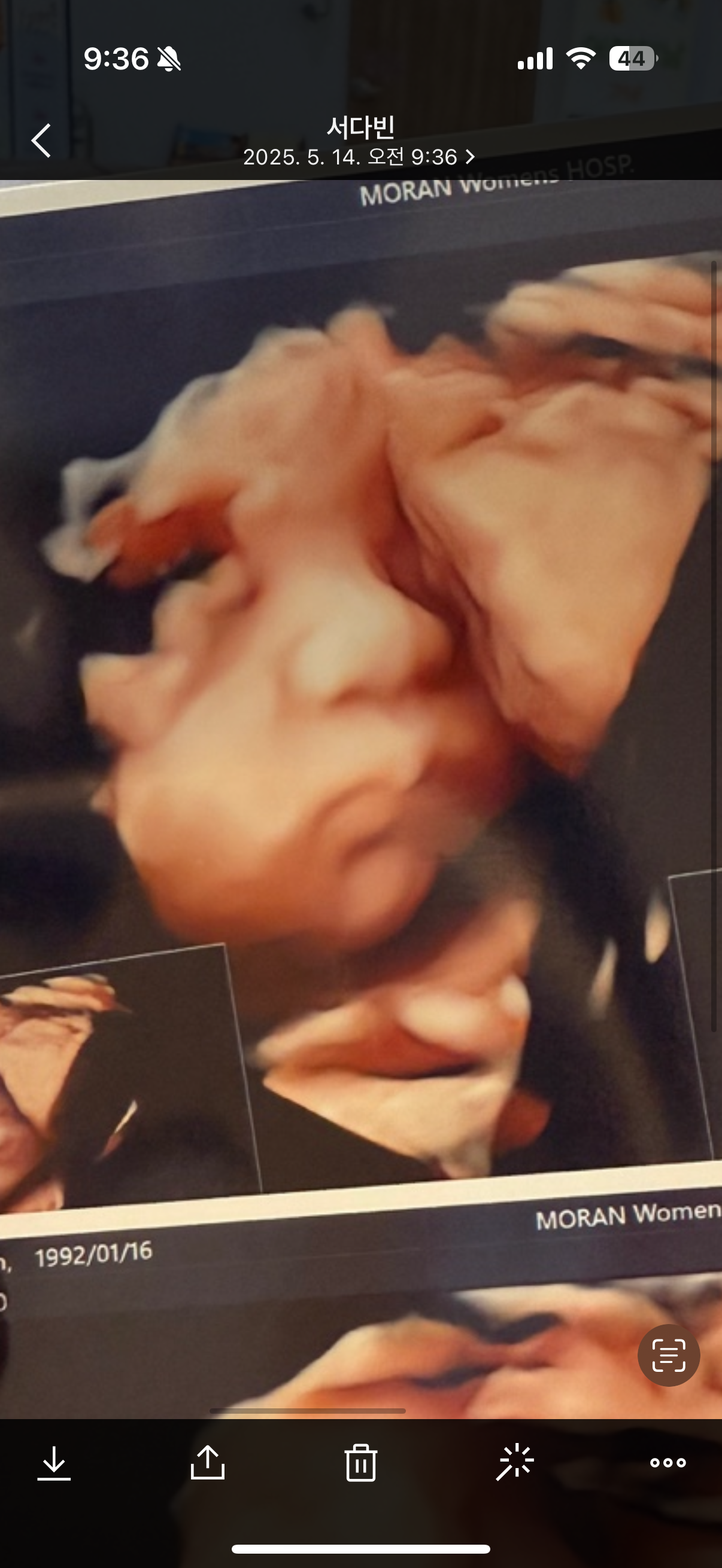 원본 초음파