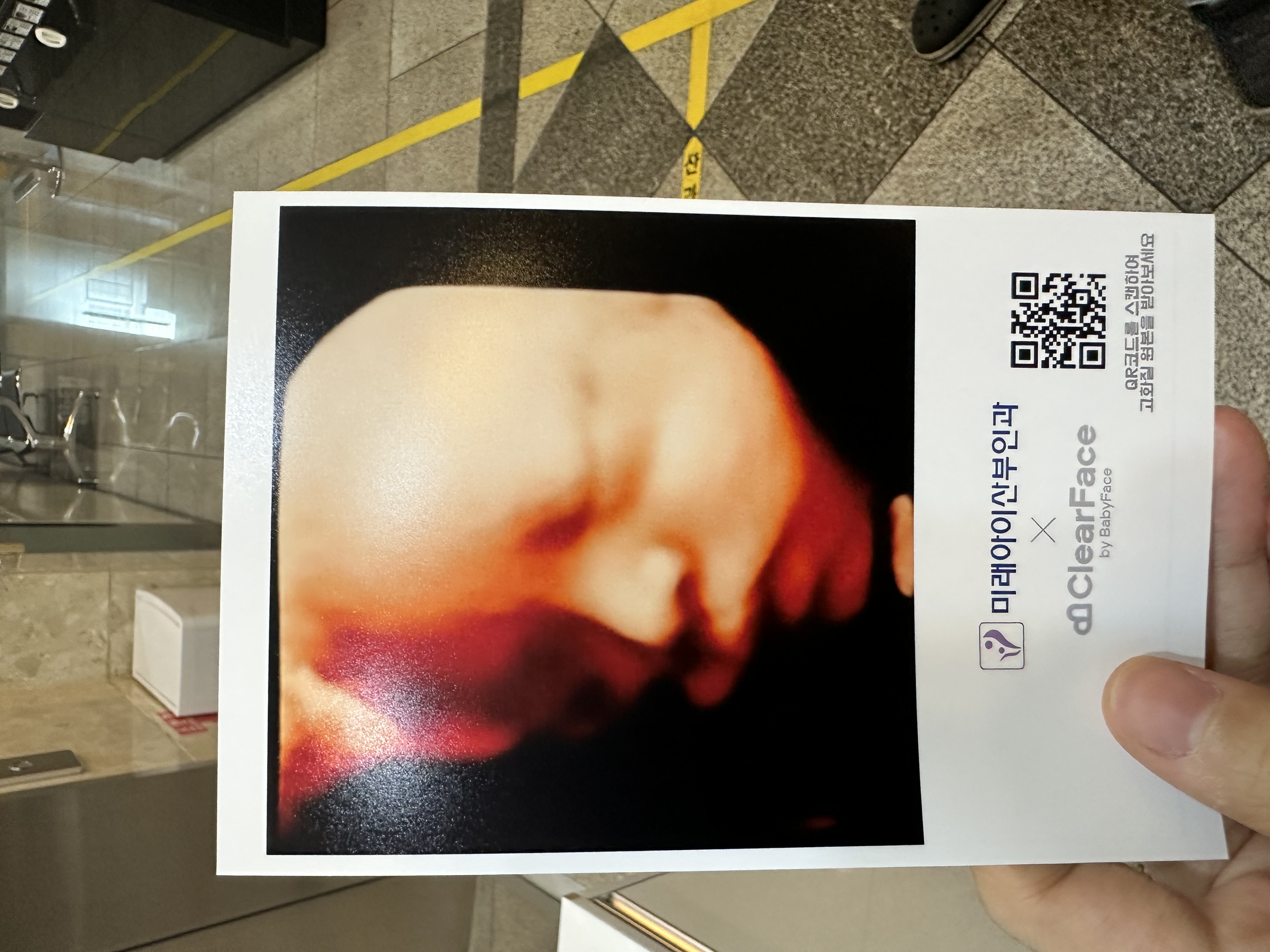 원본 초음파