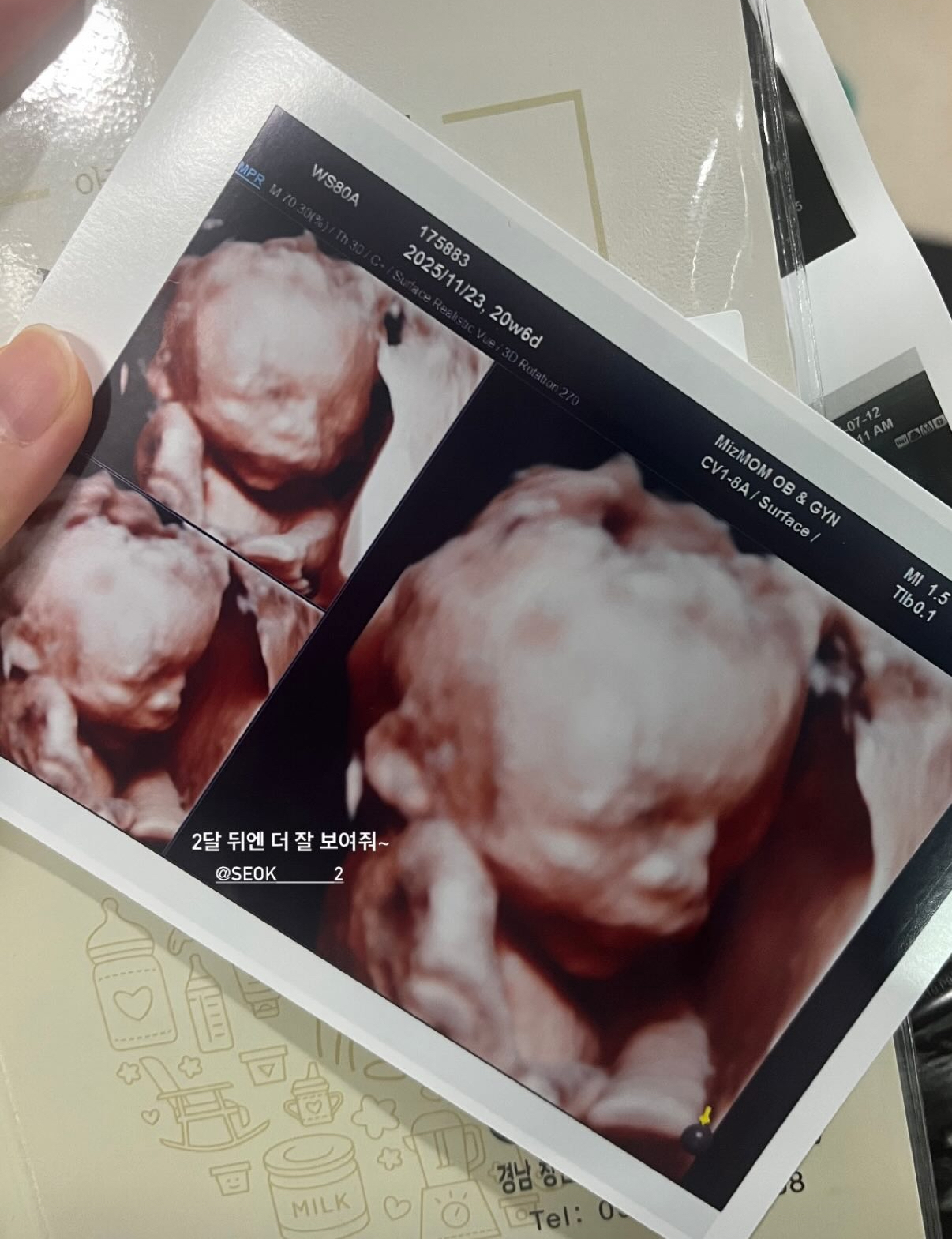 원본 초음파